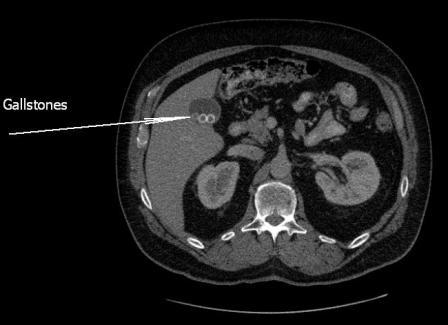 CT Scan Image