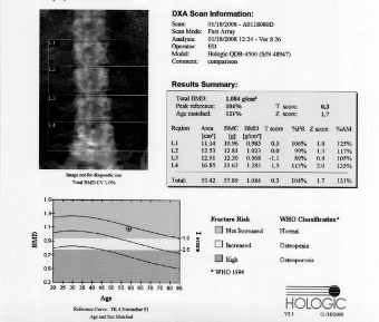 Bone Density scan results